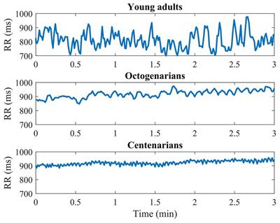 Heart Rate Variability and Exceptional Longevity